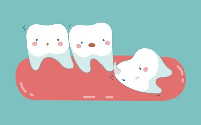 Smile Brighter: Your Guide to Wisdom Teeth Removal